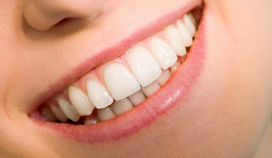 What is the Gum Recession?   