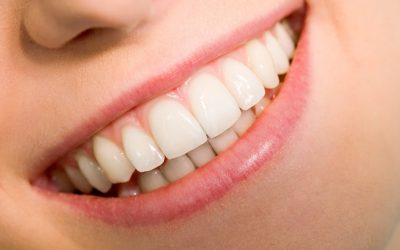 What is the Gum Recession?
