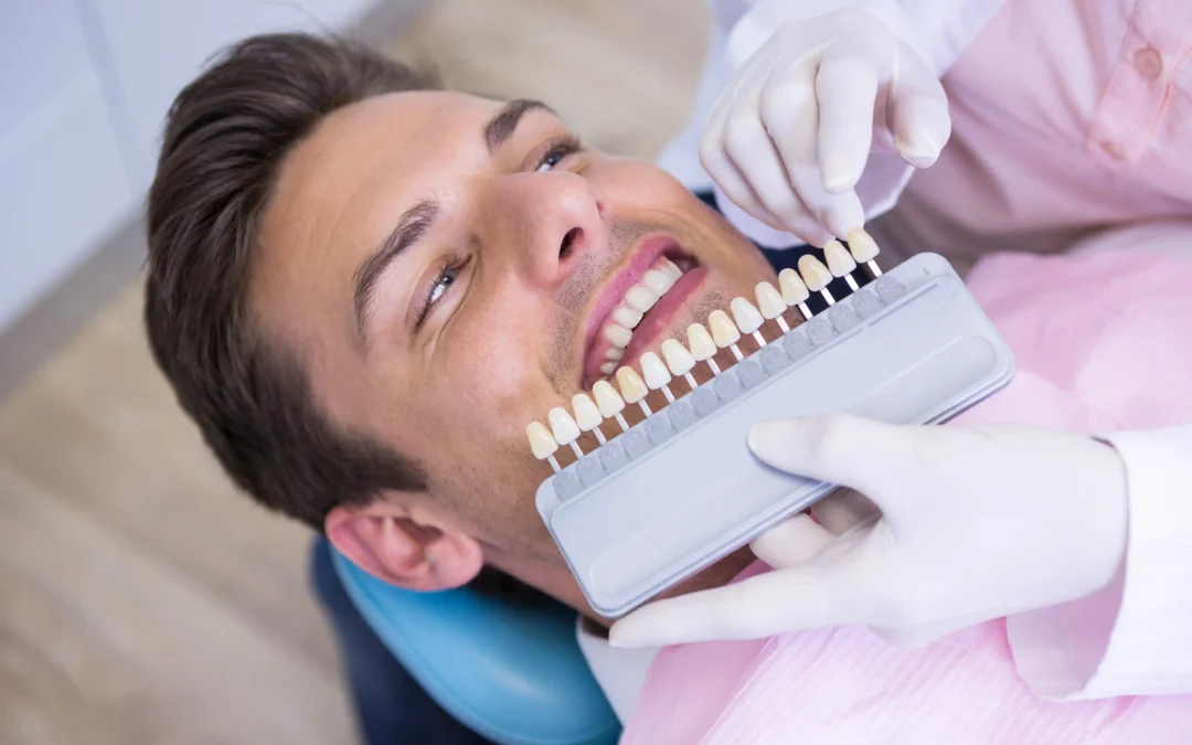 Zirconium Dental Veneers: Full Guide